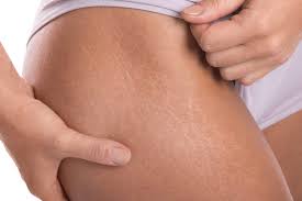 ROXY PROTOCOLLO SMAGLIATURE