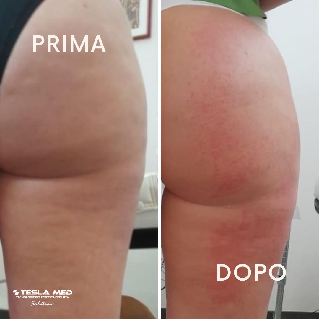 TESLA-MED TONIFICANTE E RIDUCENTE